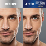 Retinol Mens Charcoal Peel Off Nose Strips - FranWilson