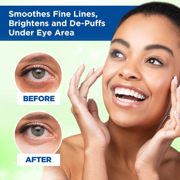 Green Tea Eye Gel Patch Fran Wilson® Nourish My Eyes Cucumber Fran